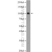 PWP2 Rabbit Polyclonal Antibody (11390-1-AP)