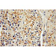 IRF4 Rabbit Polyclonal Antibody (11247-2-AP)