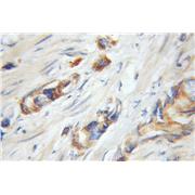 UHMK1 Rabbit Polyclonal Antibody (11624-1-AP)