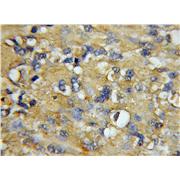 COX7A1 Rabbit Polyclonal Antibody (11413-1-AP)