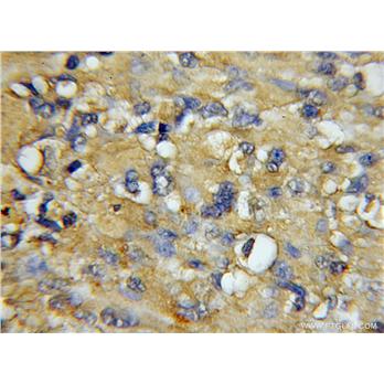 COX7A1 Rabbit Polyclonal Antibody (11413-1-AP)