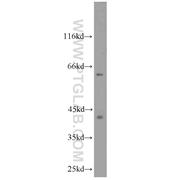 CDK9 Rabbit Polyclonal Antibody (11705-1-AP)