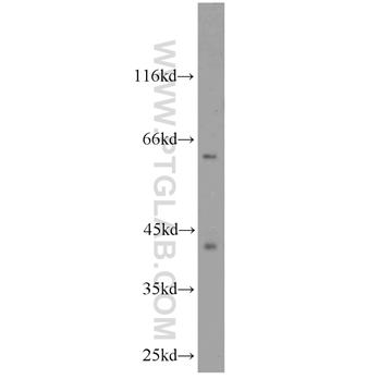 CDK9 Rabbit Polyclonal Antibody (11705-1-AP)