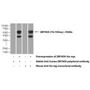 ZMYND8 Rabbit Polyclonal Antibody (11633-1-AP)