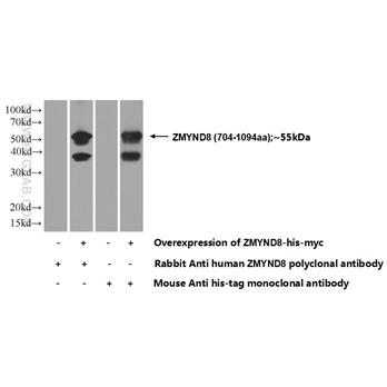 ZMYND8 Rabbit Polyclonal Antibody (11633-1-AP)