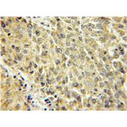 SCYL3 Rabbit Polyclonal Antibody (11249-1-AP)