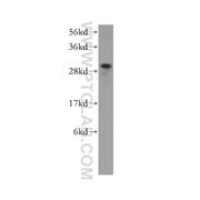 HUS1 Rabbit Polyclonal Antibody (11223-1-AP)