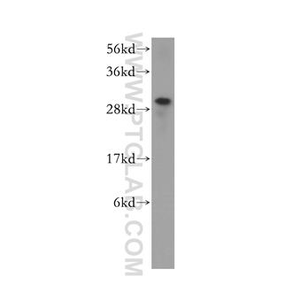 HUS1 Rabbit Polyclonal Antibody (11223-1-AP)