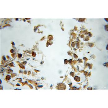 NTHL1 Rabbit Polyclonal Antibody (11154-1-AP)