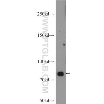 JUP Rabbit Polyclonal Antibody (11146-1-AP)
