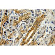 ZNF2 Rabbit Polyclonal Antibody (11282-1-AP)