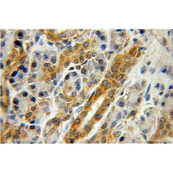 ZNF2 Rabbit Polyclonal Antibody (11282-1-AP)
