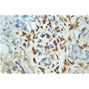 ZNF266 Rabbit Polyclonal Antibody (11374-1-AP)