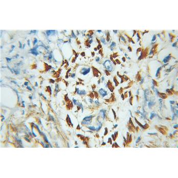 ZNF266 Rabbit Polyclonal Antibody (11374-1-AP)