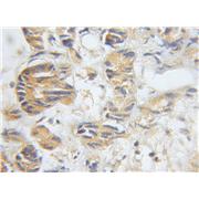 DCI Rabbit Polyclonal Antibody (11535-1-AP)