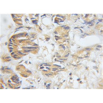 DCI Rabbit Polyclonal Antibody (11535-1-AP)