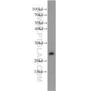 PMF1 Rabbit Polyclonal Antibody (11190-2-AP)