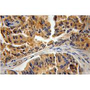CPNE3 Rabbit Polyclonal Antibody (11186-1-AP)
