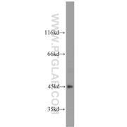 ART5 Rabbit Polyclonal Antibody (11354-1-AP)