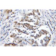CBX3 Rabbit Polyclonal Antibody (11650-2-AP)