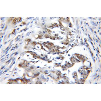 CBX3 Rabbit Polyclonal Antibody (11650-2-AP)