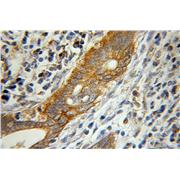 PNLIP Rabbit Polyclonal Antibody (11209-1-AP)