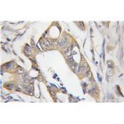 CHRNB1 Rabbit Polyclonal Antibody (11553-1-AP)