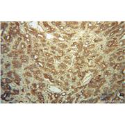 FMN2 Rabbit Polyclonal Antibody (11259-1-AP)