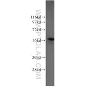 P4HB Rabbit Polyclonal Antibody (11245-1-AP)