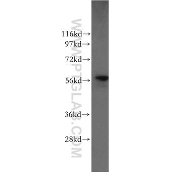 P4HB Rabbit Polyclonal Antibody (11245-1-AP)