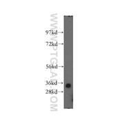ING2 Rabbit Polyclonal Antibody (11560-1-AP)