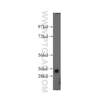 ING2 Rabbit Polyclonal Antibody (11560-1-AP)