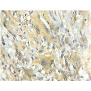 TRIM44 Rabbit Polyclonal Antibody (11511-1-AP)