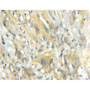 TRIM44 Rabbit Polyclonal Antibody (11511-1-AP)