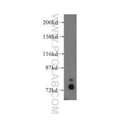 CTTN Rabbit Polyclonal Antibody (11381-1-AP)