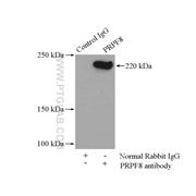 PRPF8 Rabbit Polyclonal Antibody (11171-1-AP)