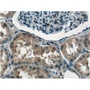 NPLOC4 Rabbit Polyclonal Antibody (11638-1-AP)