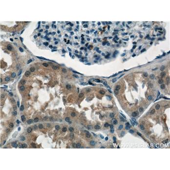 NPLOC4 Rabbit Polyclonal Antibody (11638-1-AP)