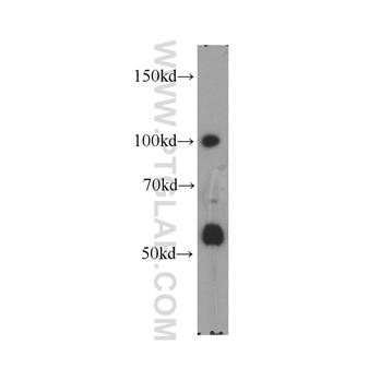 XRN2 Rabbit Polyclonal Antibody (11267-1-AP)