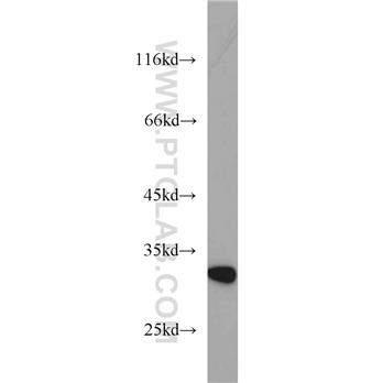 RSU1 Rabbit Polyclonal Antibody (11207-1-AP)