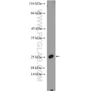 SSX1 Rabbit Polyclonal Antibody (11670-1-AP)