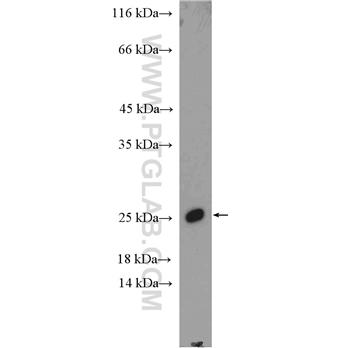 SSX1 Rabbit Polyclonal Antibody (11670-1-AP)
