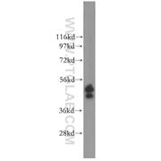 ERO1LB Rabbit Polyclonal Antibody (11261-2-AP)