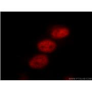TLE3 Rabbit Polyclonal Antibody (11372-1-AP)