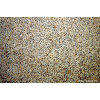 GZMA Rabbit Polyclonal Antibody (11288-1-AP)