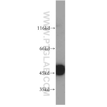 ENO1 Rabbit Polyclonal Antibody (11204-1-AP)