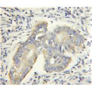 ACCS Rabbit Polyclonal Antibody (11491-1-AP)