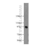 PRKD2 Rabbit Polyclonal Antibody (11623-1-AP)