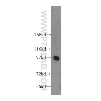 PRKD2 Rabbit Polyclonal Antibody (11623-1-AP)