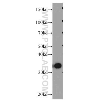 HNRNPA1 Rabbit Polyclonal Antibody (11176-1-AP)
